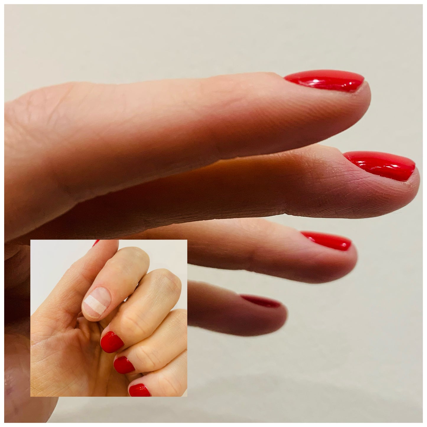 Nail Repair