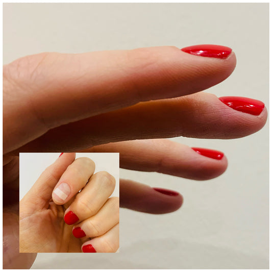 Nail Repair